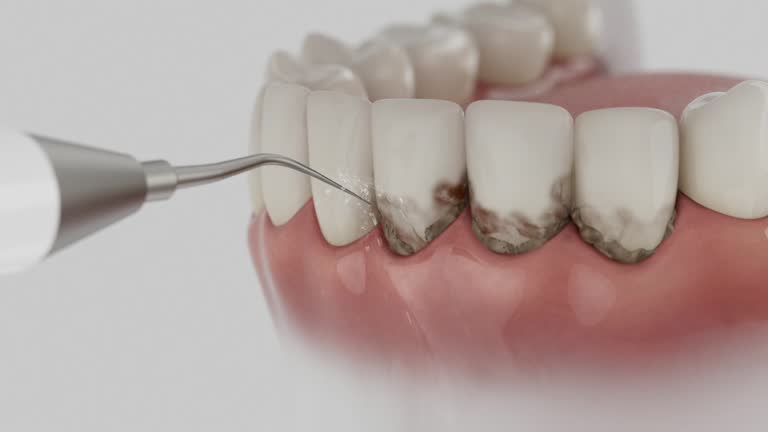 Trusted Tooth Extraction service in Algonquin, IL - Dentist Open Now